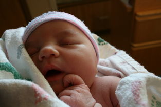 孕期妊娠合并新生儿高钾血症怎么降血钾_